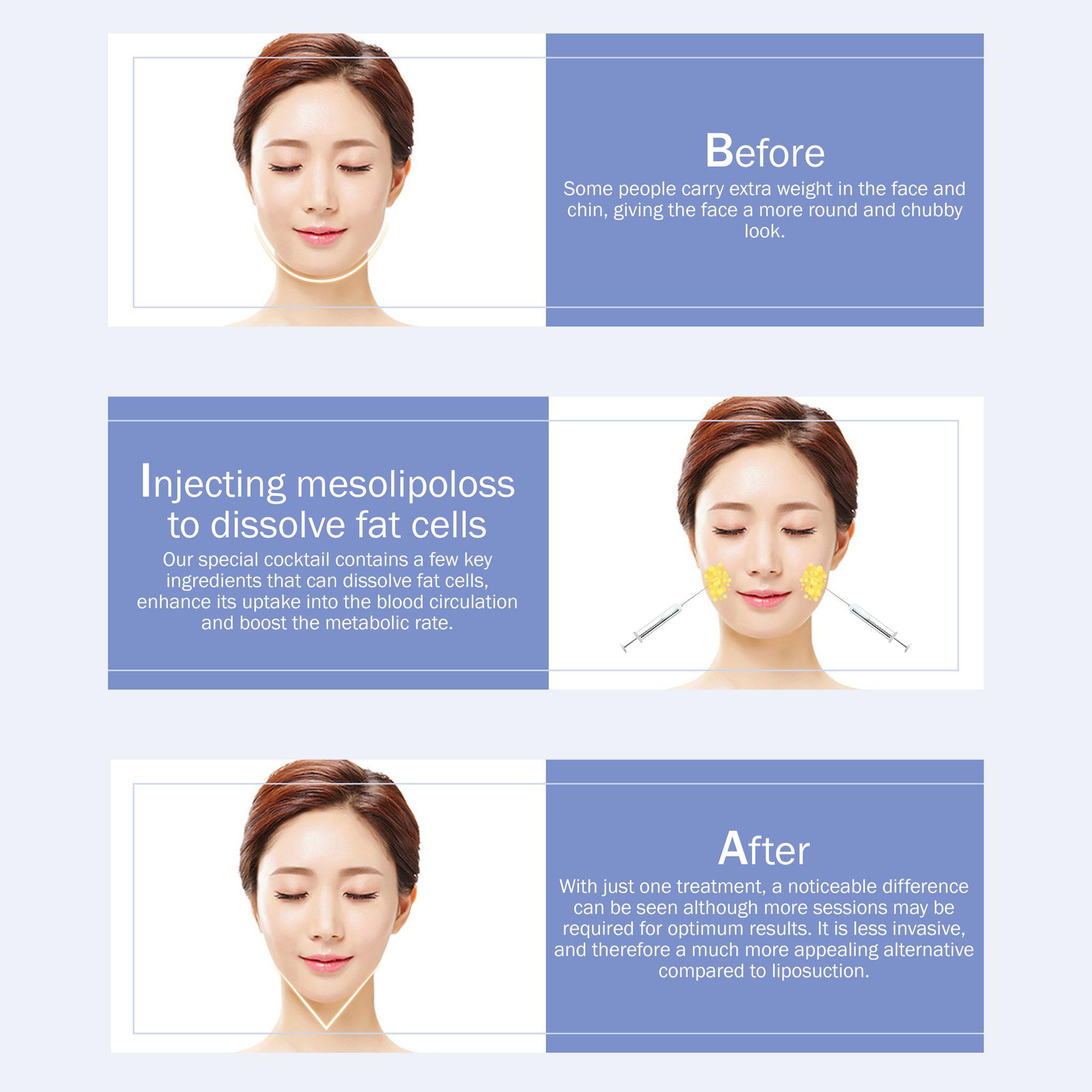 Face Slimming Treatments - SLK Clinic